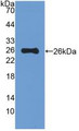 Western Blot; Sample: Recombinant MUC5B, Mouse.