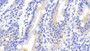 Used in DAB staining on fromalin fixed paraffin-embedded Stomach tissue