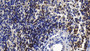 Used in DAB staining on fromalin fixed paraffin-embedded Liver tissue