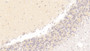 DAB staining on IHC-P; Samples: Human Cerebellum Tissue;  Primary Ab: 20μg/ml Rabbit Anti-Human MPP2 Antibody Second Ab: 2µg/mL HRP-Linked Caprine Anti-Rabbit IgG Polyclonal Antibody 