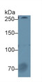 Western Blot; Sample: Human Serum; Primary Ab: 1µg/ml Rabbit Anti-Human F5 Antibody Second Ab: 0.2µg/mL HRP-Linked Caprine Anti-Rabbit IgG Polyclonal Antibody