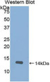 Western Blot; Sample: Recombinant protein.