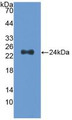 Western Blot; Sample: Recombinant Slit2, Human.