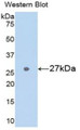 Western Blot; Sample: Recombinant protein.