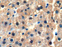 DAB staining on IHC-P; Samples: Rat Liver Tissue;  Primary Ab: 10µg/ml Rabbit Anti-Rat GSTa3 Antibod