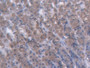 DAB staining on IHC-P; Samples: Rat Stomach Tissue;  Primary Ab: 20µg/ml Rabbit Anti-Rat GCK Antibod