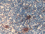 DAB staining on IHC-P; Samples: Rat Spleen Tissue;  Primary Ab: 20µg/ml Rabbit Anti-Rat TLR2 Antibod