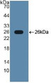 Western Blot; Sample: Recombinant TLR2, Human.