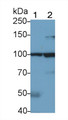 Western Blot; Sample: Recombinant TLR2, Human.