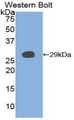 Western Blot; Sample: Recombinant protein.