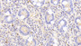 DAB staining on IHC-P; Samples: Human Small intestine Tissue; Primary Ab: 20μg/ml Rabbit Anti-Human GSTa4 Antibody Second Ab: 2µg/mL HRP-Linked Caprine Anti-Rabbit IgG Polyclonal Antibody