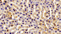 DAB staining on IHC-P; Samples: Rat Liver Tissue; Primary Ab: 10μg/ml Rabbit Anti-Rat GSTm1 Antibody Second Ab: 2µg/mL HRP-Linked Caprine Anti-Rabbit IgG Polyclonal Antibody