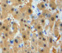 DAB staining on fromalin fixed paraffin-embedded liver tissuev)