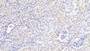 DAB staining on IHC-P; Samples: Human Kidney Tissue;  Primary Ab: 20μg/ml Rabbit Anti-Human GSTm2 Antibody Second Ab: 2µg/mL HRP-Linked Caprine Anti-Rabbit IgG Polyclonal Antibody 
