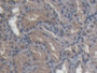 DAB staining on IHC-P; Samples: Porcine Kidney Tissue; Primary Ab: 20µg/ml Rabbit Anti-Porcine DAO Antibody Second Ab: 2µg/mL HRP-Linked Caprine Anti-Rabbit IgG Polyclonal Antibody