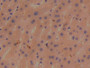 DAB staining on IHC-P; Samples: Human Liver Tissue;  Primary Ab: 20µg/ml Rabbit Anti-Human BMP1 Anti