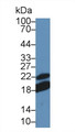 Western Blot; Sample: Mouse Lymph node lysate; Primary Ab: 5µg/ml Rabbit Anti-Mouse CD28 Antibody Second Ab: 0.2µg/mL HRP-Linked Caprine Anti-Rabbit IgG Polyclonal Antibody