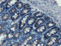 DAB staining on IHC-P; Samples: Rat Small intestine Tissue; Primary Ab: 10µg/ml Rabbit Anti-Rat HABP1 Antibody Second Ab: 2µg/mL HRP-Linked Caprine Anti-Rabbit IgG Polyclonal Antibody