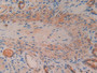 DAB staining on IHC-P; Samples: Rat Stomach Tissue; Primary Ab: 10µg/ml Rabbit Anti-Rat Smad1 Antibody Second Ab: 2µg/mL HRP-Linked Caprine Anti-Rabbit IgG Polyclonal Antibody