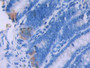 DAB staining on IHC-P; Samples: Rat Small intestine Tissue; Primary Ab: 30µg/ml Rabbit Anti-Rat BMP6 Antibody Second Ab: 2µg/mL HRP-Linked Caprine Anti-Rabbit IgG Polyclonal Antibody