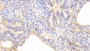 DAB staining on IHC-P; Samples: Human Lung Tissue; Primary Ab: 20μg/ml Rabbit Anti-Human AGER Antibody Second Ab: 2µg/mL HRP-Linked Caprine Anti-Rabbit IgG Polyclonal Antibody