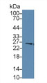 Western Blot; Sample: Human Liver lysate; Primary Ab: 2µg/ml Rabbit Anti-Human GSTm4 Antibody Second Ab: 0.2µg/mL HRP-Linked Caprine Anti-Rabbit IgG Polyclonal Antibody