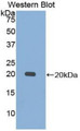 Western Blot; Sample: Recombinant protein.