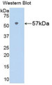 Western Blot; Sample: Recombinant protein.