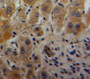 Used in DAB staining on fromalin fixed paraffin-embedded Liver tissue