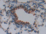 DAB staining on IHC-P; Samples: Mouse Lung Tissue; Primary Ab: 10µg/ml Rabbit Anti-Mouse HEXb Antibody Second Ab: 2µg/mL HRP-Linked Caprine Anti-Rabbit IgG Polyclonal Antibody
