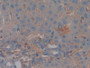 DAB staining on IHC-P; Samples: Rat Liver Tissue; Primary Ab: 10µg/ml Rabbit Anti-Rat CFH Antibody Second Ab: 2µg/mL HRP-Linked Caprine Anti-Rabbit IgG Polyclonal Antibody