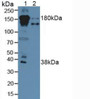 Western Blot; Sample: Lane1: Human Serum; Lane2: Human Liver Tissue.