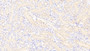 DAB staining on IHC-P; Samples: Mouse Kidney Tissue; Primary Ab: 20μg/ml Rabbit Anti-Mouse PDGFBB Antibody Second Ab: 2µg/mL HRP-Linked Caprine Anti-Rabbit IgG Polyclonal Antibody