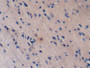 DAB staining on fromalin fixed paraffin-embedded Kidney tissue)