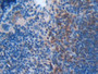 DAB staining on fromalin fixed paraffin- embedded spleen tissue)