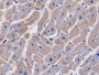 DAB staining on IHC-P; Samples: Human Cardiac Muscle Tissue;  Primary Ab: 10µg/ml Rabbit Anti-Human CASP9 Antibody Second Ab: 2µg/mL HRP-Linked Caprine Anti-Rabbit IgG Polyclonal Antibody 