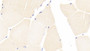DAB staining on IHC-P; Samples: Human Skeletal muscle Tissue; Primary Ab: 20μg/ml Rabbit Anti-Human CASP9 Antibody Second Ab: 2µg/mL HRP-Linked Caprine Anti-Rabbit IgG Polyclonal Antibody