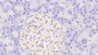 DAB staining on IHC-P; Samples: Human Pancreas Tissue;  Primary Ab: 20μg/ml Rabbit Anti-Human CASP9 Antibody Second Ab: 2µg/mL HRP-Linked Caprine Anti-Rabbit IgG Polyclonal Antibody 