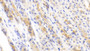 DAB staining on IHC-P; Samples: Mouse Stomach Tissue;  Primary Ab: 20μg/ml Rabbit Anti-Mouse RELA Antibody Second Ab: 2µg/mL HRP-Linked Caprine Anti-Rabbit IgG Polyclonal Antibody 