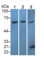 Western Blot; Sample: Lane1: Human Serum; Lane2: Human Lung lysate; Lane3: Mouse Kidney lysate; Primary Ab: 3μg/ml Rabbit Anti-Human RELA Antibody; Second Ab: 0.2µg/mL HRP-Linked Caprine Anti-Rabbit IgG Polyclonal Antibody;