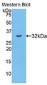 Western Blot; Sample: Recombinant protein.