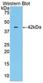 Western Blot; Sample: Recombinant protein.