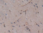 DAB staining on IHC-P; Samples: Rat Spinal cord Tissue; Primary Ab: 10µg/ml Rabbit Anti-Rat GSTt2 Antibody Second Ab: 2µg/mL HRP-Linked Caprine Anti-Rabbit IgG Polyclonal Antibody