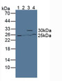 Western Blot; Sample: Lane1: Mouse Kidney Tissue; Lane2: Mouse Pancreas Tissue; Lane3: Mouse Lung Tissue; Lane4: Mouse Liver Tissue.