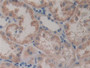 DAB staining on IHC-P; Samples: Human Kidney Tissue; Primary Ab: 10µg/ml Rabbit Anti-Human GSTt2 Antibody Second Ab: 2µg/mL HRP-Linked Caprine Anti-Rabbit IgG Polyclonal Antibody