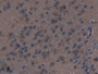 DAB staining on IHC-P; Samples: Mouse Brain Tissue; Primary Ab: 10µg/ml Rabbit Anti-Mouse THBS1 Antibody Second Ab: 2µg/mL HRP-Linked Caprine Anti-Rabbit IgG Polyclonal Antibody