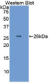 Western Blot; Sample: Recombinant protein.