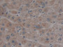 DAB staining on IHC-P; Samples: Human Liver Tissue;  Primary Ab: 10µg/ml Rabbit Anti-Human NGB Antib