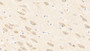 DAB staining on IHC-P; Samples: Porcine Cerebrum Tissue; Primary Ab: 10μg/ml Rabbit Anti-Porcine ADP Antibody Second Ab: 2µg/mL HRP-Linked Caprine Anti-Rabbit IgG Polyclonal Antibody