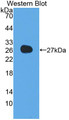 Western Blot; Sample: Recombinant protein.